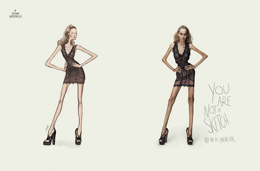 You’re Not a Sketch. Say No to Anorexia