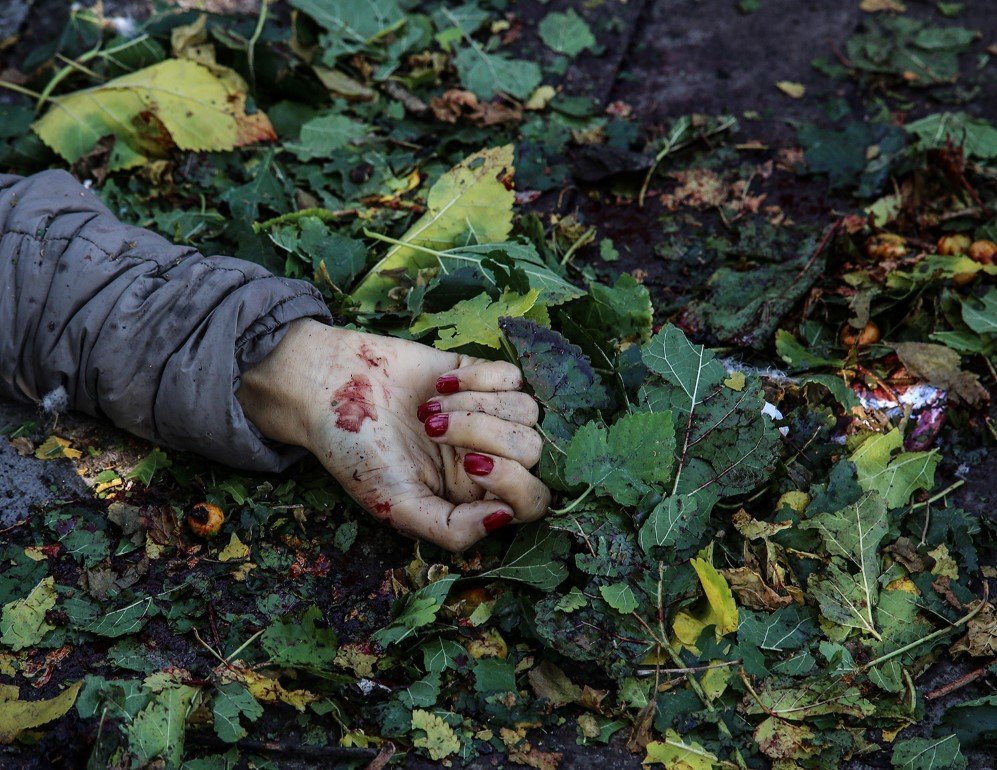 A blood-covered hand of a victim is seen at the blast site after an explosion during a peace march in Ankara, Turkey. At least 86 people were killed and several wounded in twin explosions outside Ankara’s main train station – Oct. 10, 2015