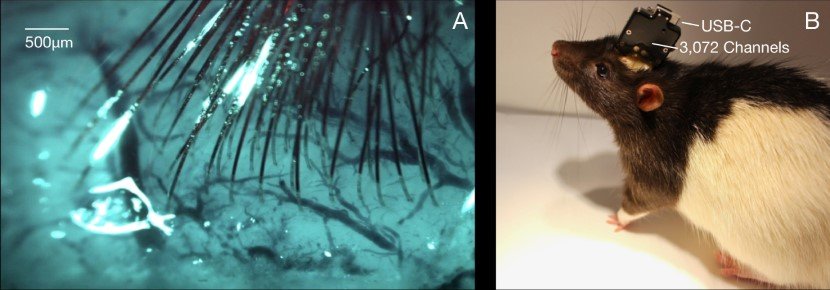 Human Brain Implant Neuralink