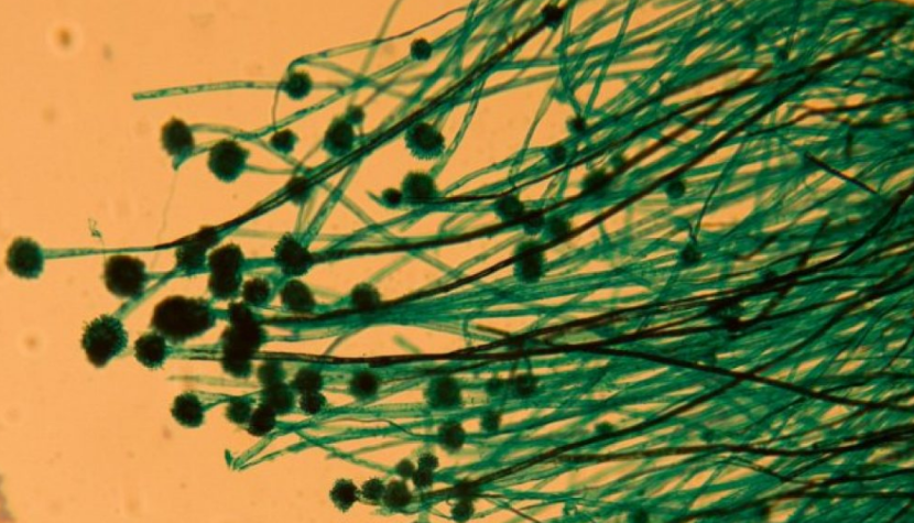 Aspergillus tubingensis Plastic Eating Bacteria